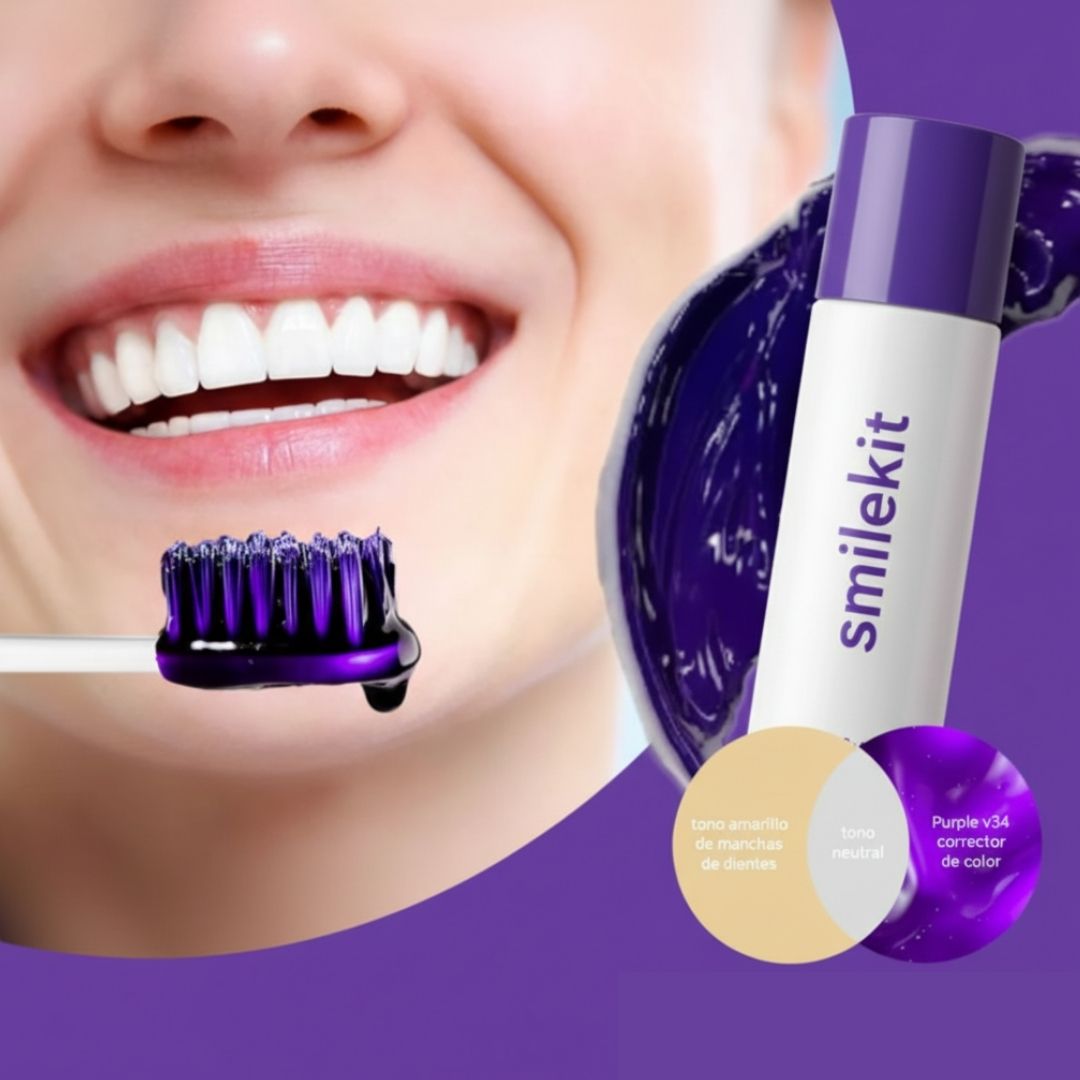 ESPUMA BLANQUEADORA DE DIENTES: SMILEKIT