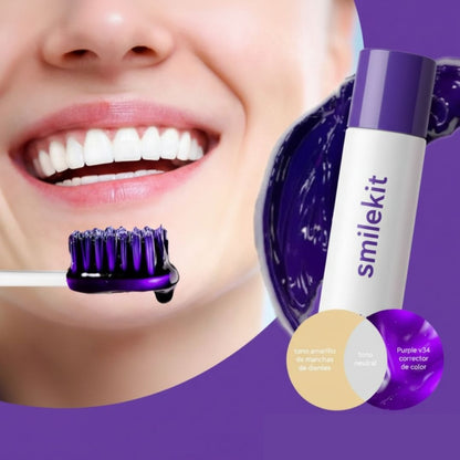 ESPUMA BLANQUEADORA DE DIENTES: SMILEKIT